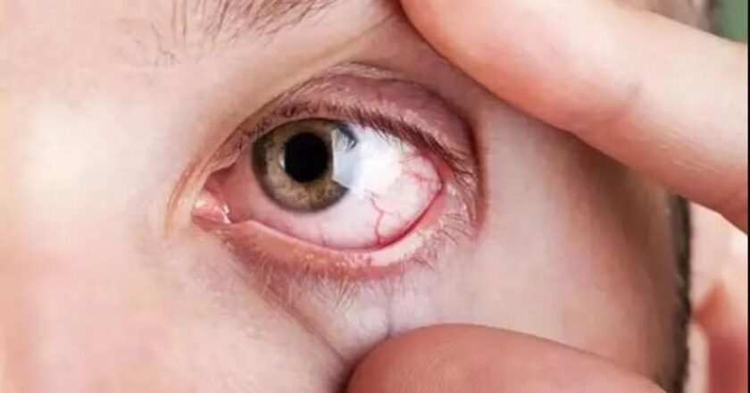 Göz tansiyonuna karşı 40 yaş üstü herkes düzenli muayene olmalı