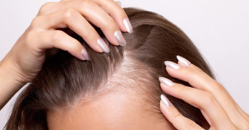 Dermatologdan İpuçları: Mevsimsel Saç Dökülmesinin Sebepleri Neler?